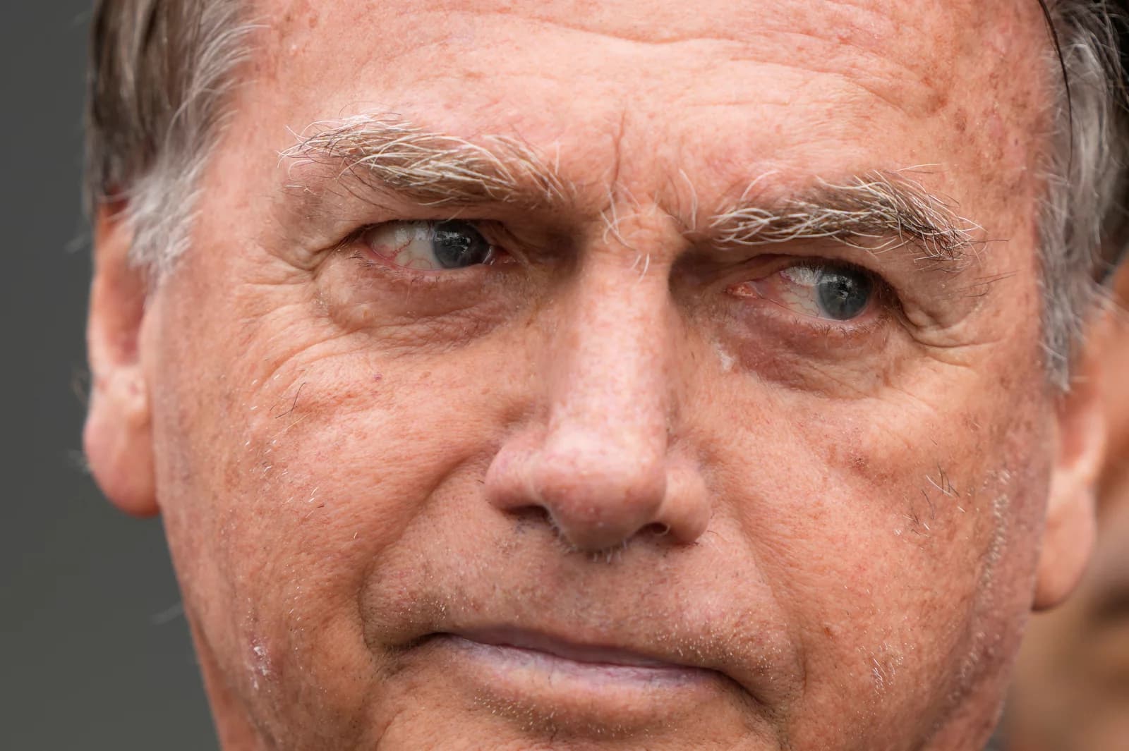 Kritis di ICU! Mantan Presiden Brasil Dilarikan ke Rumah Sakit, Nyawa Terancam?